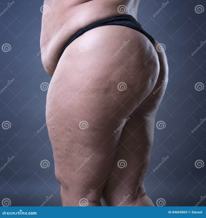 Женщина с толстым животом